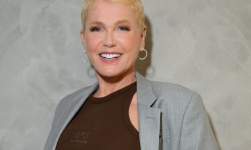 Xuxa comemora resultado de transplante capilar: “Gosto de ter pouquinho cabelo”
