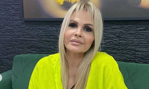 Monique Evans exibe resultado surpreendente de cirurgia plástica no rosto